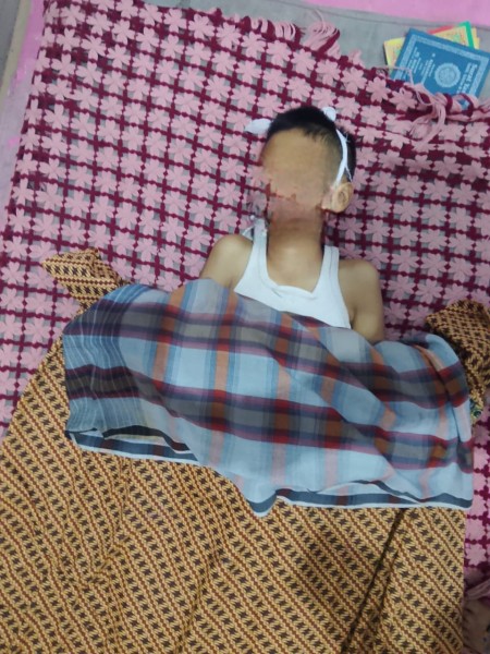 Murid SD di Pekanbaru Tewas, Diduga Setelah Dibully Teman Sekelas