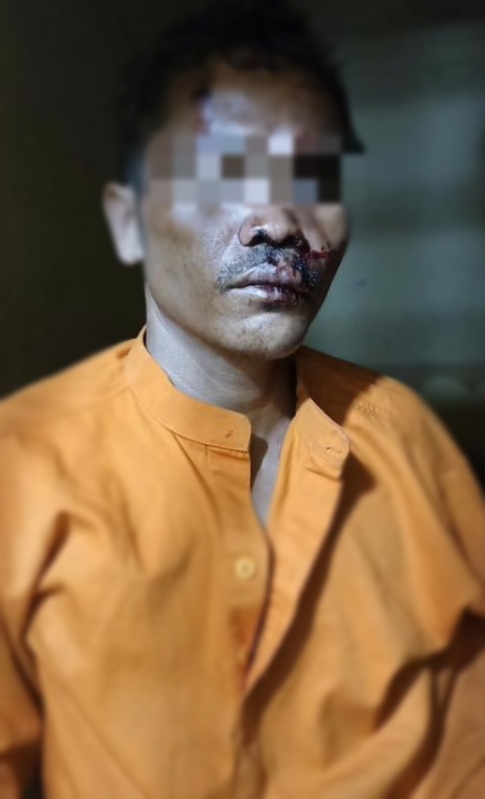 Sadis, Bayi Berumur 7 Bulan di Rokan Hulu Riau Dikampak Tetangganya Hingga Meninggal Dunia
